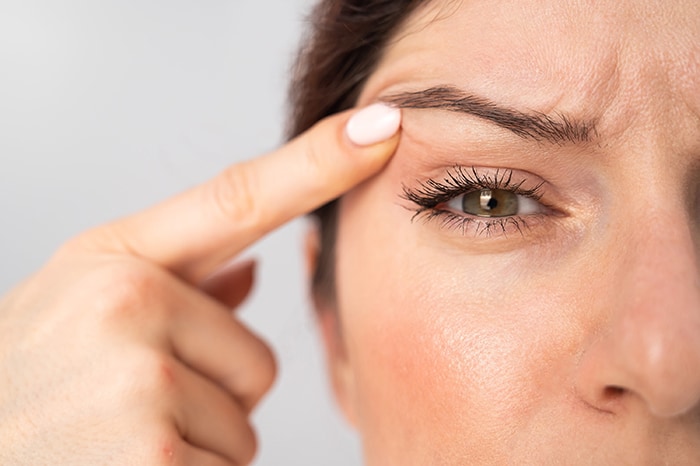 Is There a “Mini” Brow Lift Procedure?